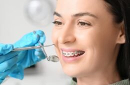 Everything You Need to Know About Orthodontic Treatment: Braces for a Perfect Smile